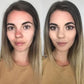 Tri-Coloured Concealer Palette Om Acne Littekens En Donkere Kringen Te Bedekken